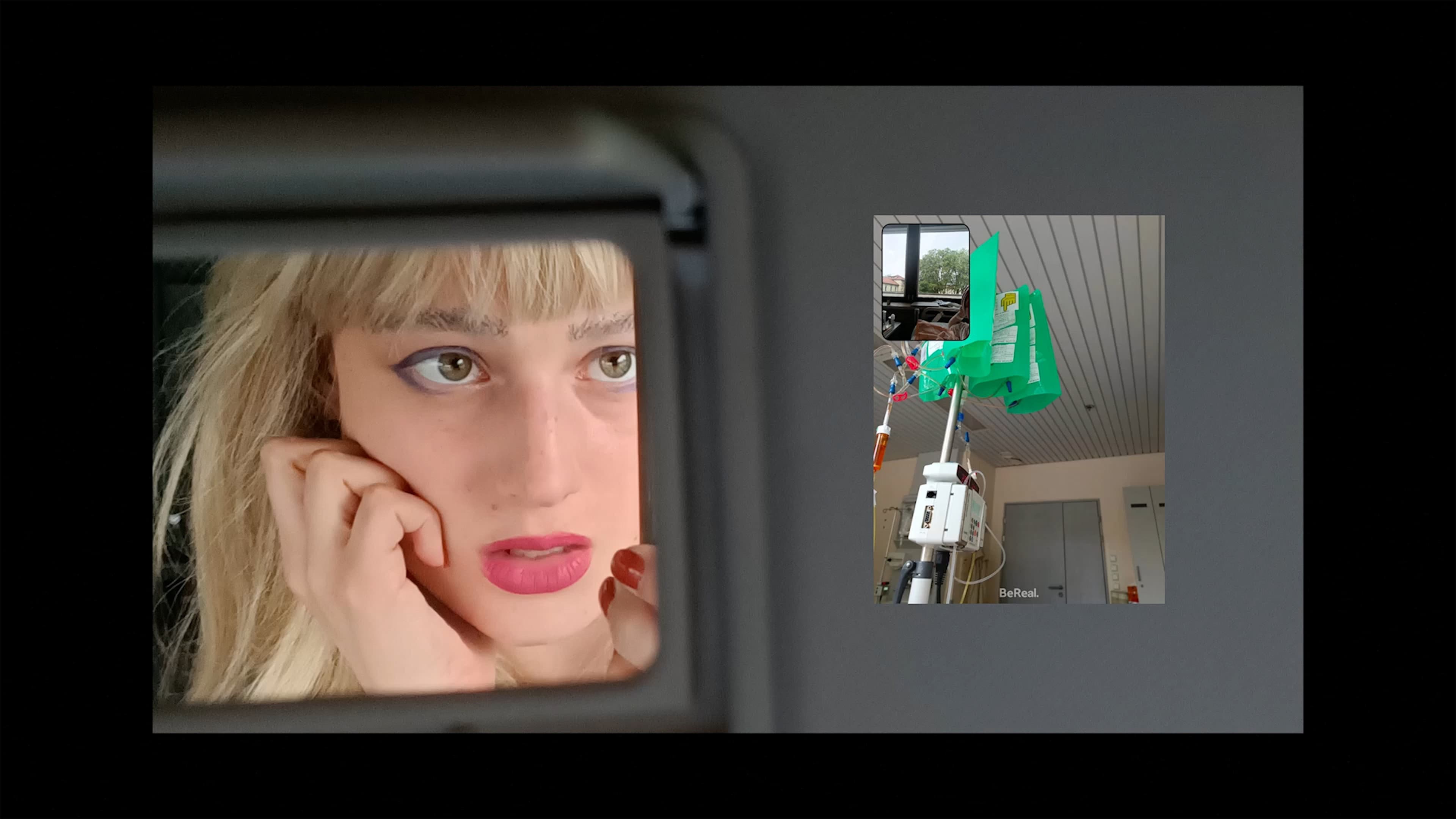 Razcepljene konice