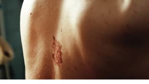 Original Wound — foto 1