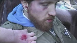 Hulk Blood Tapes — foto 1