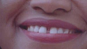 Gap-Toothed Women — foto 3