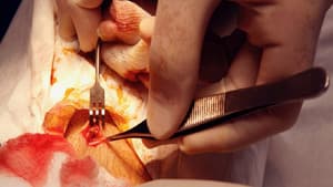 Patient Seventeen — foto 3