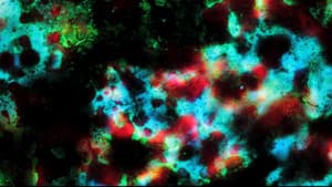 Pigment-Dispersion Syndrome — foto 2