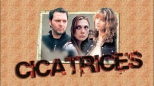 Cicatrices — foto 2