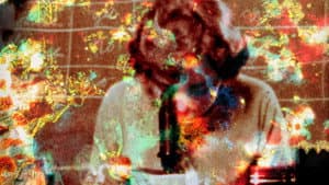 Pigment-Dispersion Syndrome — foto 1