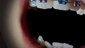 Open Wide — foto 4