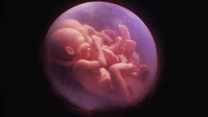 In the Womb: Multiples — foto 3