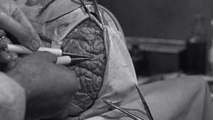 The Brain That Wouldn't Die — foto 11