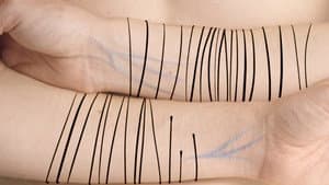 Scars — foto 1