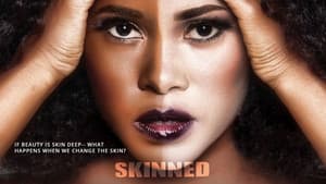 Skinned — foto 1