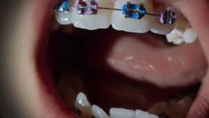 Open Wide — foto 3