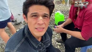 Episodio 141