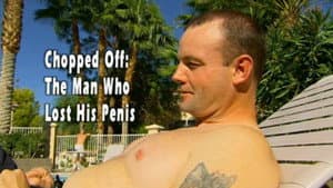 Chopped Off: The Man Who Lost His Penis — foto 1