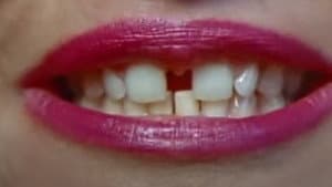Gap-Toothed Women — foto 2