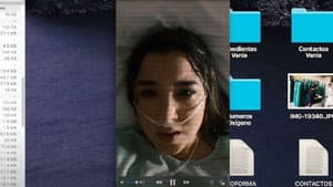 Hipoxemia — foto 1