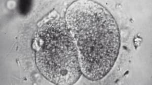 Test Tube Babies — foto 1