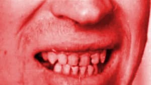 Episodio 10