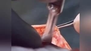 Episodio 13