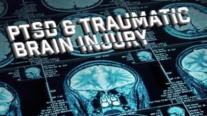 Joel Hunt: Traumatic Brain Injury (TBI) — foto 1