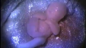 Busted Babies — foto 1