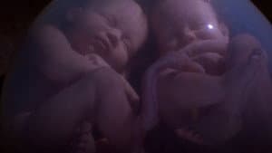 In the Womb: Multiples — foto 2