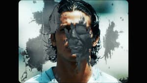 Vitiligo — foto 1