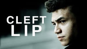 Cleft Lip — foto 1