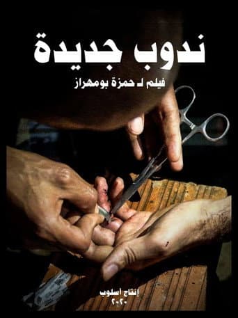 ندوب جديدة