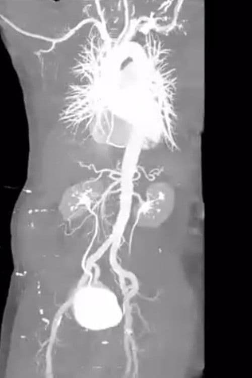 X-Ray Eros