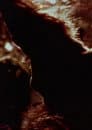 Duplicity III